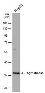 AGMAT Antibody in Western Blot (WB)