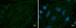 AOC2 Polyclonal Antibody