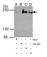 ARID2 Antibody in Immunoprecipitation (IP)