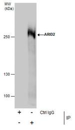 ARID2 Antibody in Immunoprecipitation (IP)