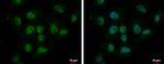 CBX6 Polyclonal Antibody