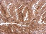 DMPK Polyclonal Antibody