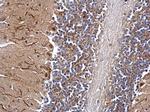 DNTTIP1 Polyclonal Antibody