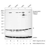 Phospho-eNOS (Ser1177) Antibody in Western Blot (WB)