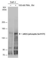 Phospho-eNOS (Ser1177) Antibody in Western Blot (WB)