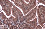 Phospho-eNOS (Ser1177) Antibody in Immunohistochemistry (Paraffin) (IHC (P))