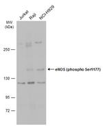 Phospho-eNOS (Ser1177) Antibody in Western Blot (WB)