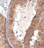 FAM131A Antibody in Immunohistochemistry (Paraffin) (IHC (P))