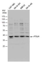 FTSJ1 Polyclonal Antibody