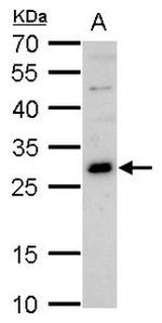 GSX2 Antibody in Western Blot (WB)