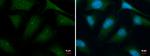 HBS1L Polyclonal Antibody