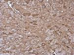 HKDC1 Antibody in Immunohistochemistry (Paraffin) (IHC (P))