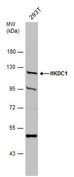 HKDC1 Antibody in Western Blot (WB)
