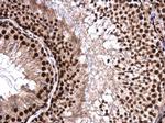 hnRNP H2 Antibody in Immunohistochemistry (Paraffin) (IHC (P))