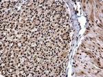 hnRNP DL Antibody in Immunohistochemistry (Paraffin) (IHC (P))
