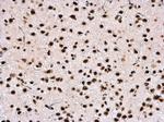 hnRNP DL Antibody in Immunohistochemistry (Paraffin) (IHC (P))