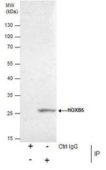 HOXB5 Antibody in Immunoprecipitation (IP)