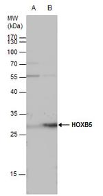 HOXB5 Polyclonal Antibody