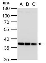HOXD13 Polyclonal Antibody