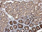 ITGB6 Antibody in Immunohistochemistry (Paraffin) (IHC (P))