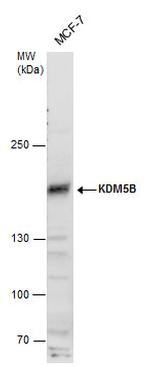 KDM5B Polyclonal Antibody