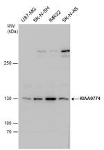 CAZIP Antibody in Western Blot (WB)