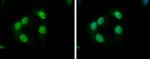 KLHL26 Polyclonal Antibody