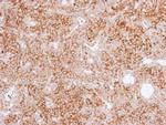 MAP4 Antibody in Immunohistochemistry (Paraffin) (IHC (P))