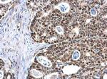 MCM6 Antibody in Immunohistochemistry (Paraffin) (IHC (P))