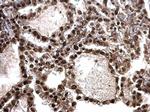 MCM6 Antibody in Immunohistochemistry (Paraffin) (IHC (P))