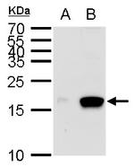 MIA Polyclonal Antibody