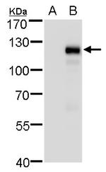 MKL1 Polyclonal Antibody