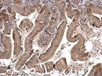 MTO1 Antibody in Immunohistochemistry (Paraffin) (IHC (P))