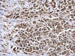 NAV2 Polyclonal Antibody