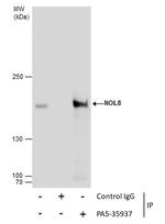 NOL8 Antibody in Immunoprecipitation (IP)