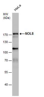 NOL8 Antibody in Western Blot (WB)