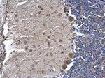NTE Polyclonal Antibody