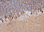 PDDC1 Polyclonal Antibody