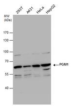 PGM1 Antibody in Western Blot (WB)