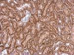 PPEF2 Polyclonal Antibody
