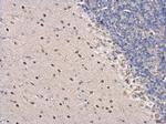 PSPC1 Antibody in Immunohistochemistry (Paraffin) (IHC (P))