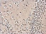 PSPC1 Antibody in Immunohistochemistry (Paraffin) (IHC (P))