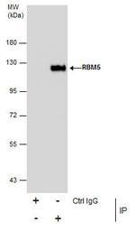 RBM5 Antibody in Immunoprecipitation (IP)