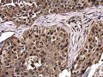 RERG Antibody in Immunohistochemistry (Paraffin) (IHC (P))