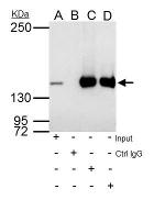 RFC1 Antibody in Immunoprecipitation (IP)
