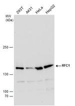 RFC1 Polyclonal Antibody
