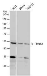 SEC62 Polyclonal Antibody