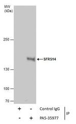 SUGP2 Antibody in Immunoprecipitation (IP)