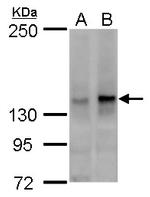 SUGP2 Polyclonal Antibody