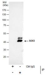 SOX3 Antibody in Immunoprecipitation (IP)